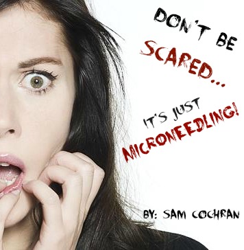 Don’t Be Scared…Its Just Micro-needling!